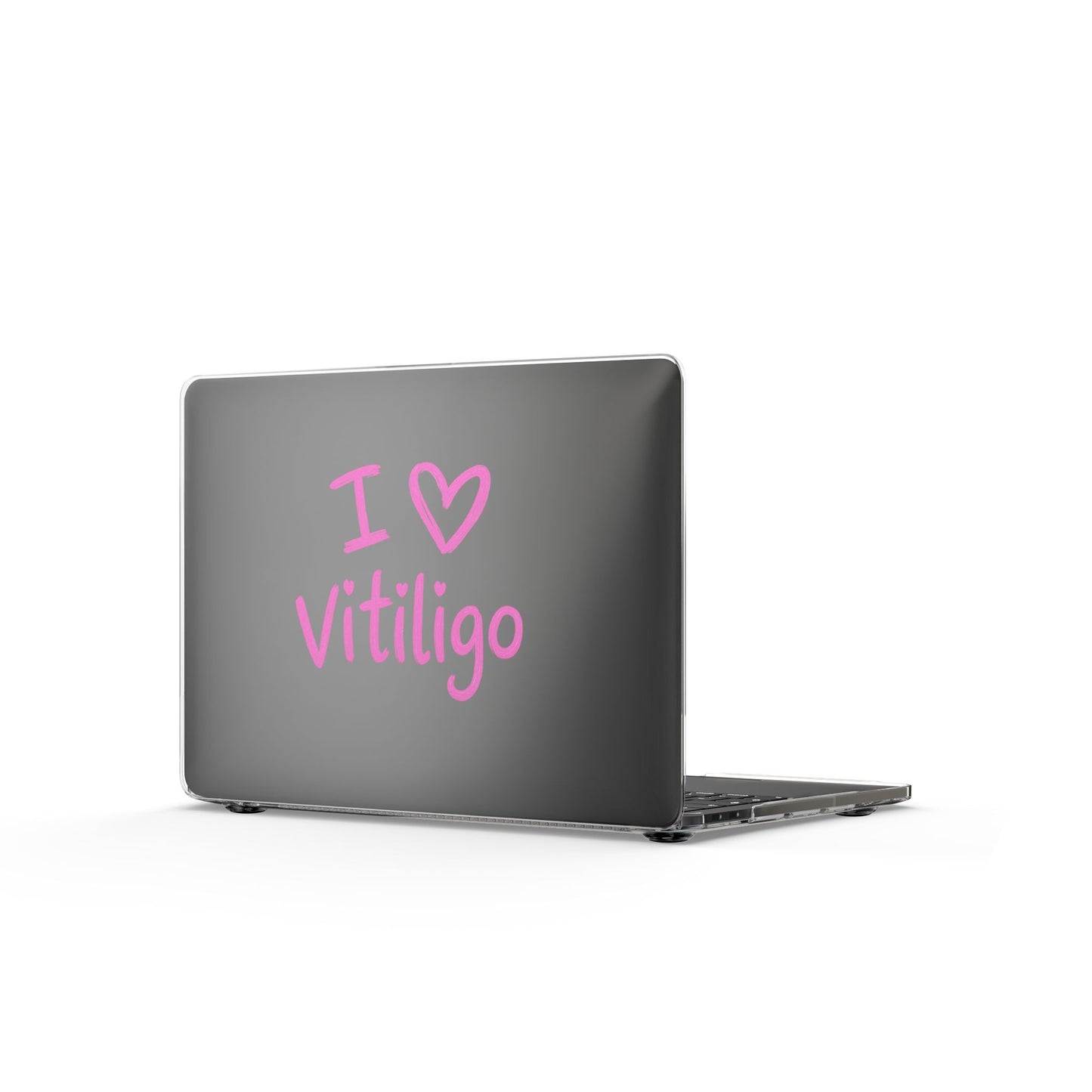 Clear MacBook Case — I  Vitiligo Pink Pride Laptop Cover
