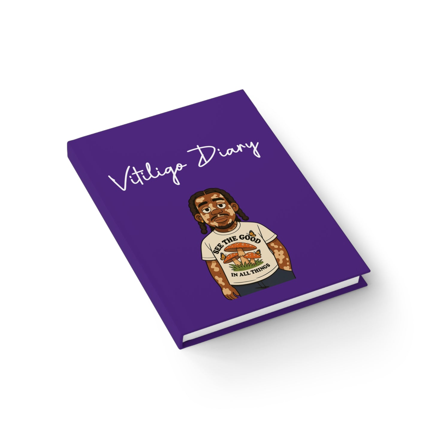 Vitiligo Diary - Inspirational Journal for Self-Reflection and Creativity