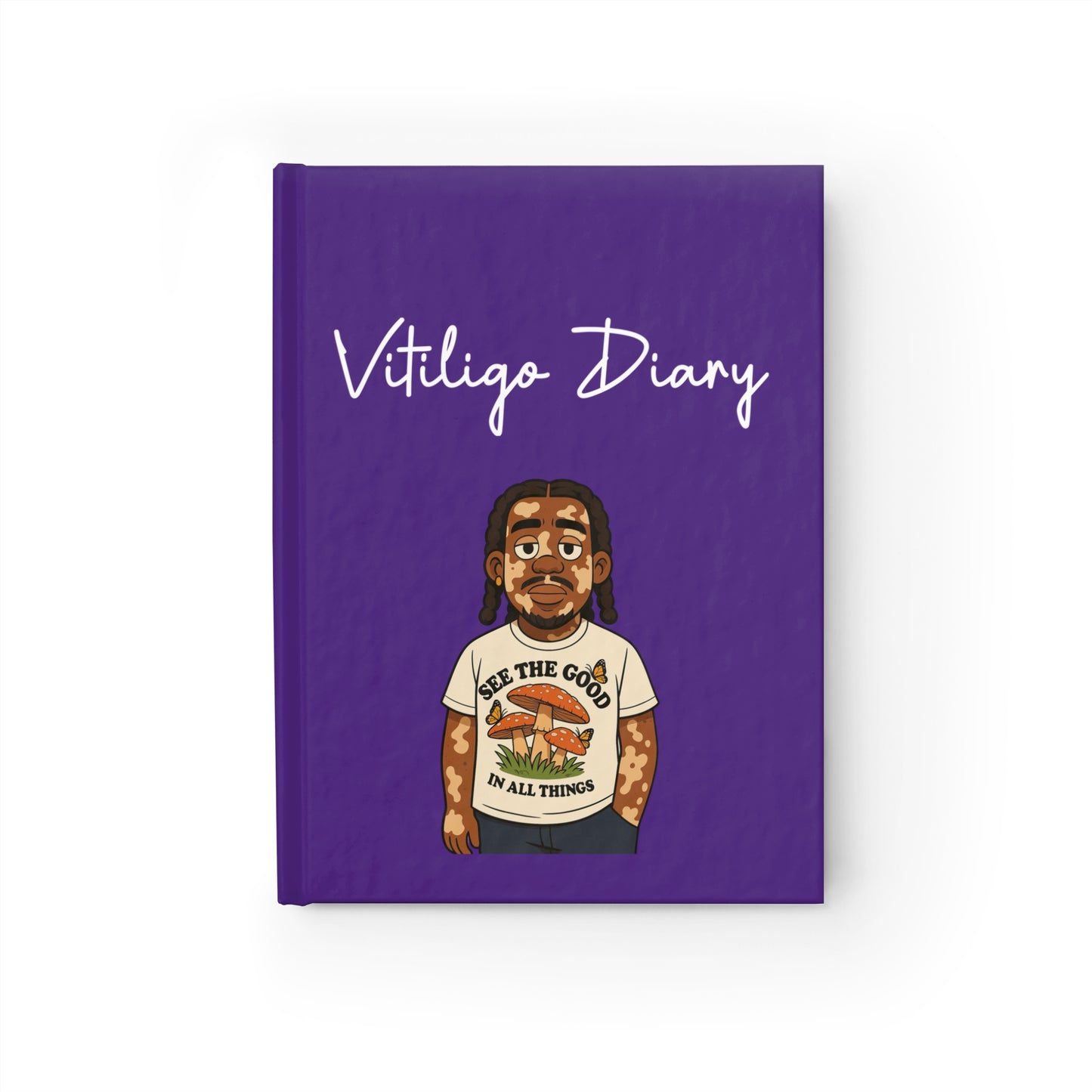 Vitiligo Diary - Inspirational Journal for Self-Reflection and Creativity