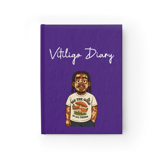 Vitiligo Diary - Inspirational Journal for Self-Reflection and Creativity