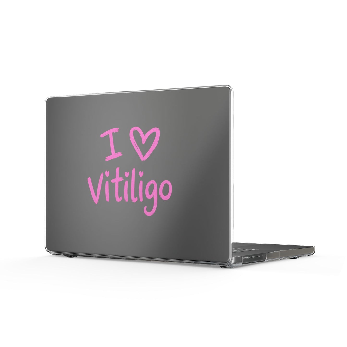 Clear MacBook Case — I  Vitiligo Pink Pride Laptop Cover
